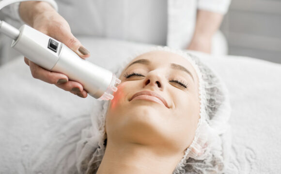 Laser de Picosegundos: tratamento eficiente e rápido para o Melasma